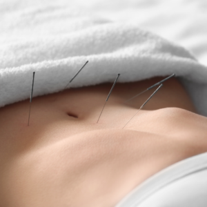 Beneficios da Acupuntura: Como essa prática milenar pode te ajudar