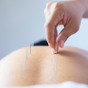 Acupuntura_15 tratamento para infertilidade com acupuntura