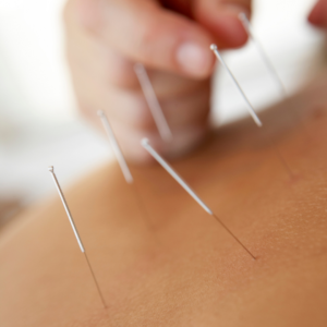 Alivio dor na cervical tratamento para dor na cervical